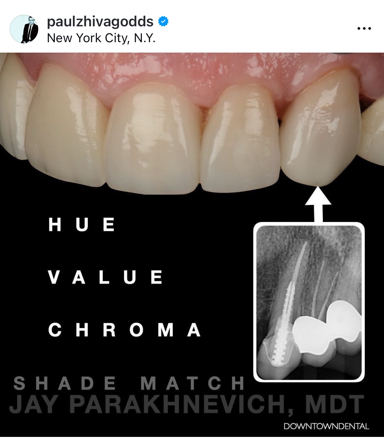 Custom Shade Match